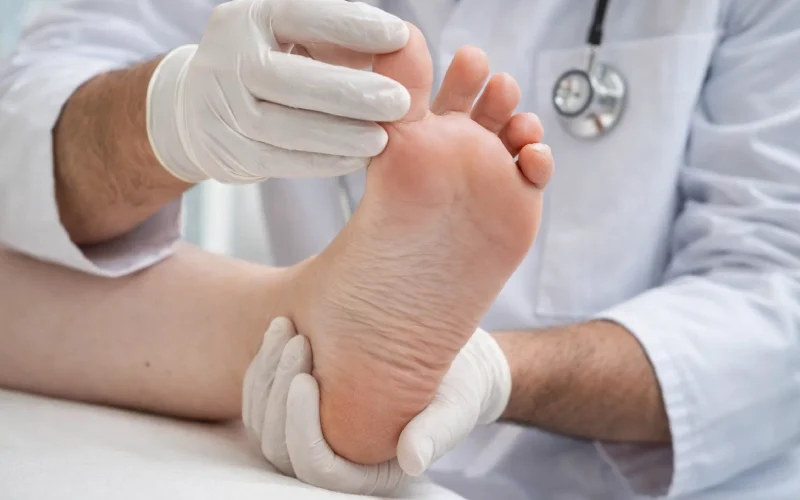 ایجاد میخچه پا