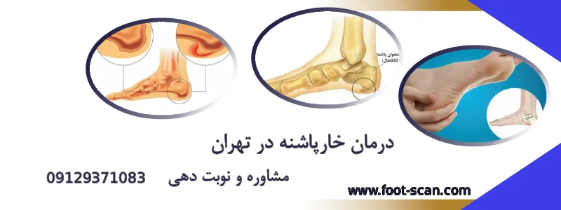 درمان خار پاشنه در تهران