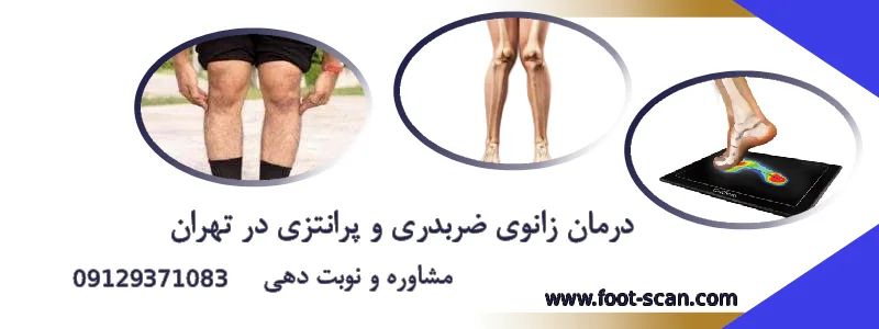 Treatment of crossed and braced knees in Tehran