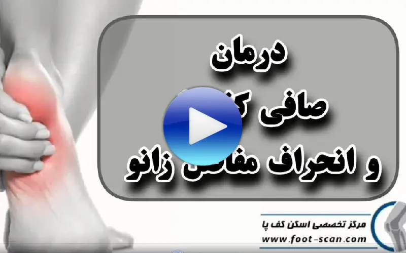 درمان صافی کف پا و انحراف مفاصل زنو