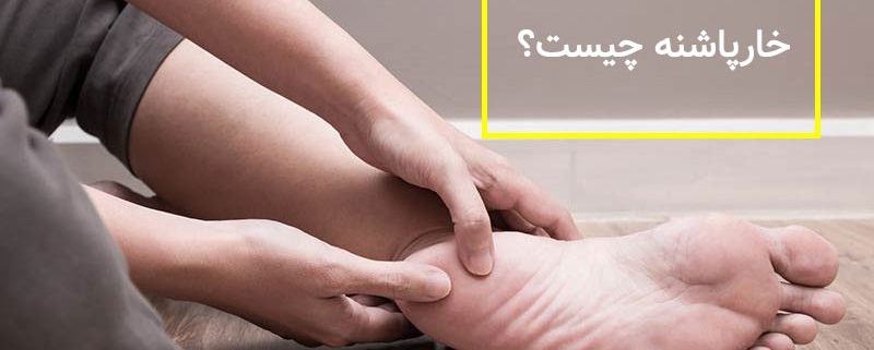درمان خار پاشنه در تهران, درمان خار پاشنه در کرج