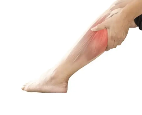 درمان درد ساق پا | علائم درد ساق پا