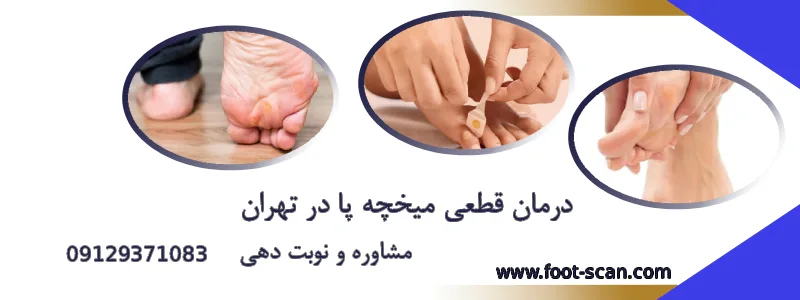 درمان میخچه در تهران