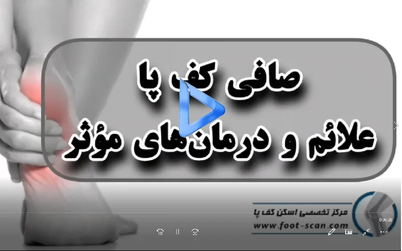 غلائم و درمان های صافی کف پا