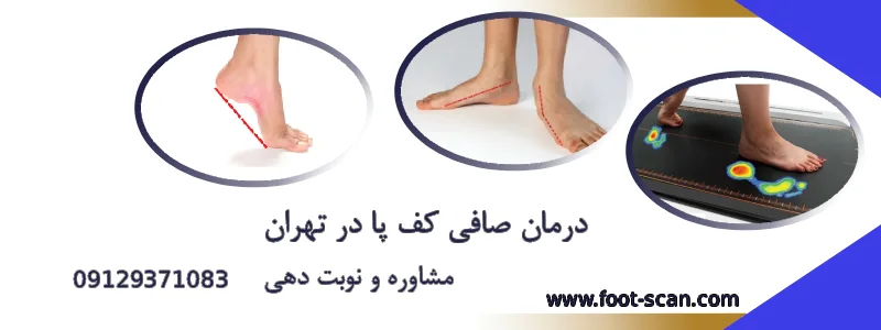 درمان صافی کف پا در شهر تهران
