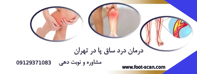 درمان درد ساق پا در تهران