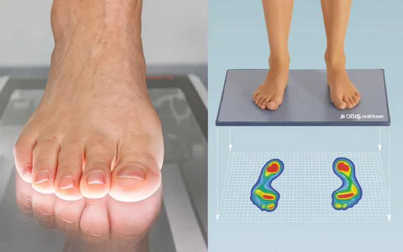 استفاده از اسکن کف پا در کرج