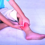 درمان درد ساق پا در تهران