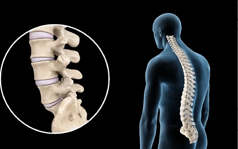 عوامل ایجاد کمر درد در کرج