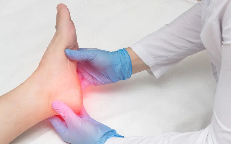 Heel spur treatment in Tehran درمان خار پاشنه در تهران