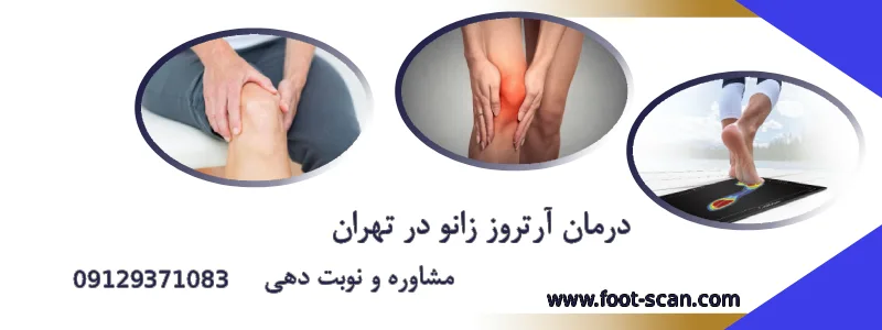 مشاوره آرتروز زانو در تهران