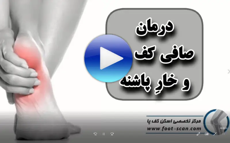 درمان کف پای صاف و خار پاشنه