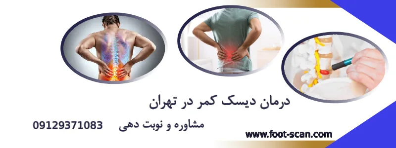 درمان دیسک کمر در تهران