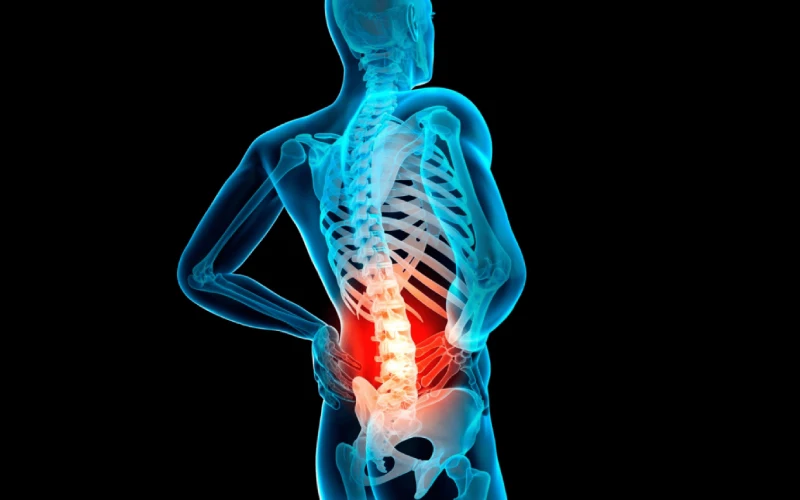 دیسک و اعصاب سیاتیک