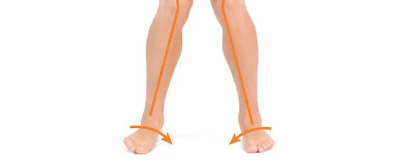 درمان زانو ضربدری