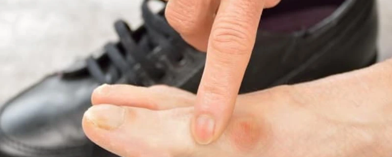 عوارض کفش های غیر استاندارد