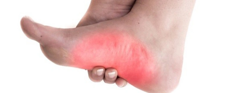 وجود فشارهای غیر متعادل کف پا