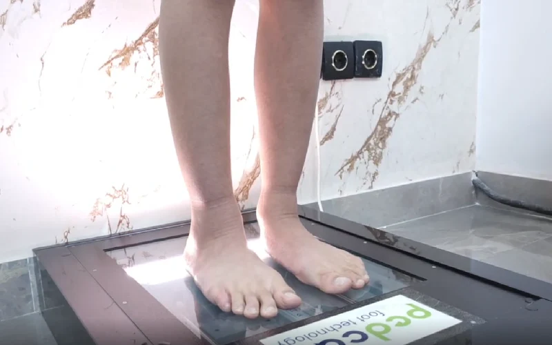 کاربردهای اسکن پا برای درمان میخچه