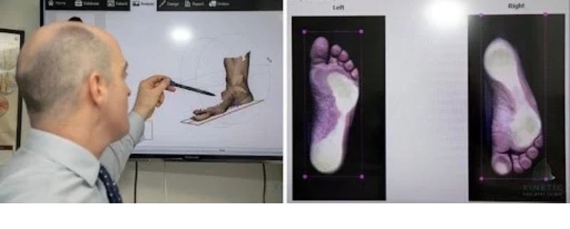 مزایای اسکن کف پا