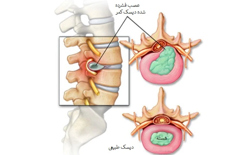 دیسک طبیعی
