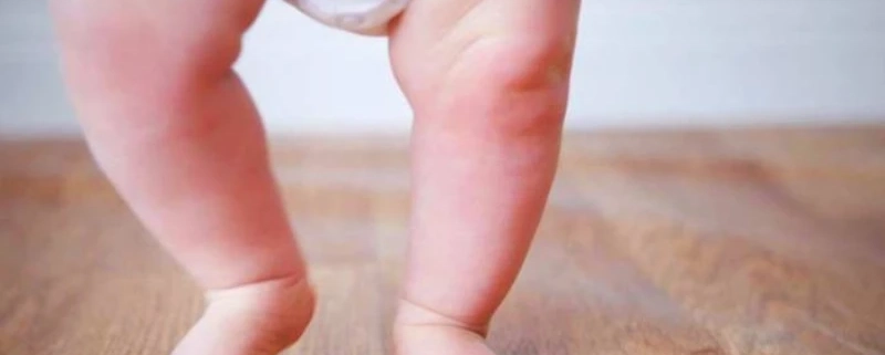 پای پرانتزی چگونه ایجاد می شود؟