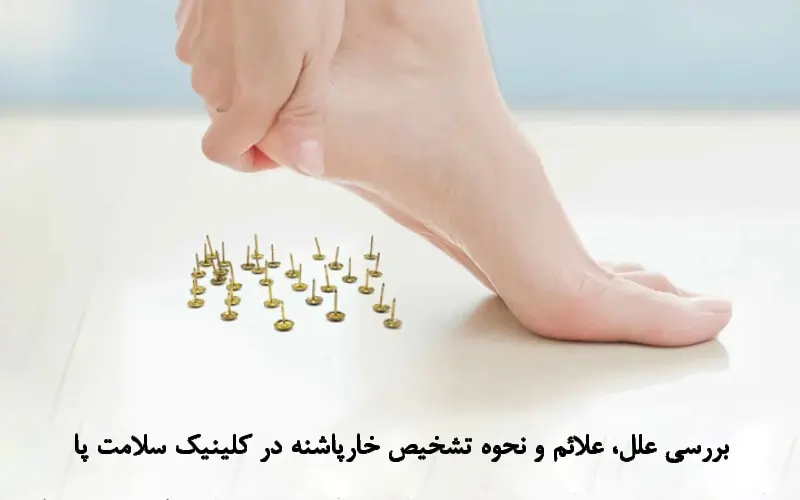 بررسی نحوه تشخیص خارپاشنه