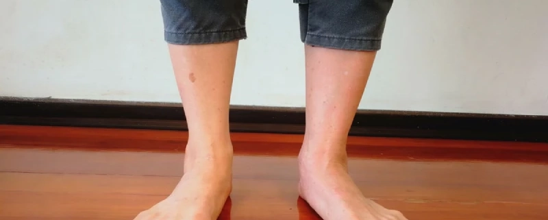 صافی کف پا در بزرگسالان به چه علت است؟