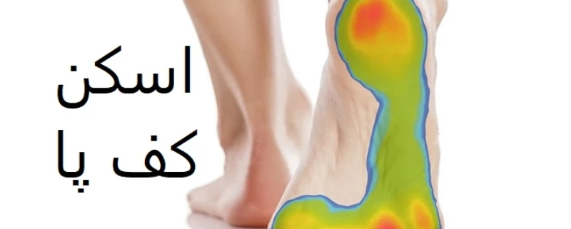 مزایای اسکن کف پا