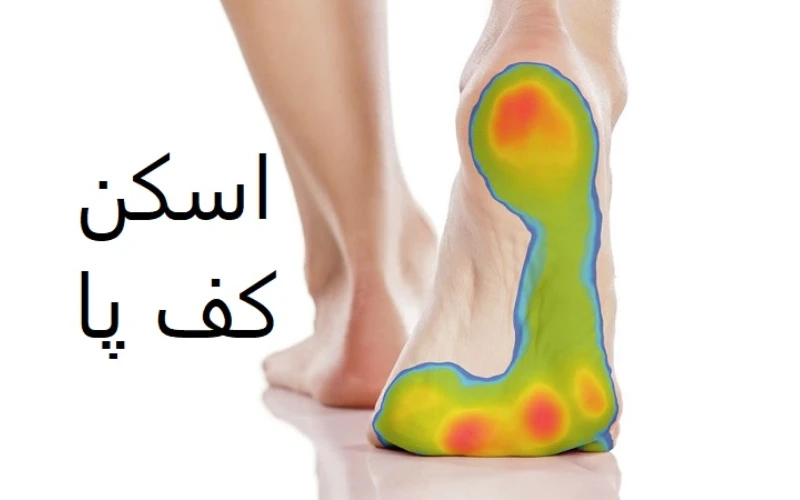 مزایای اسکن کف پا