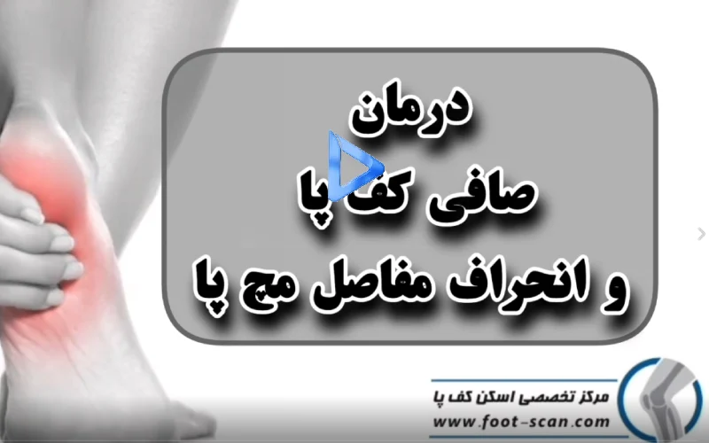درمان دفورمیتی مچ پا