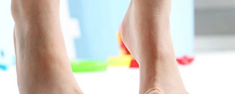 دفورمیتی مچ پا چیست؟