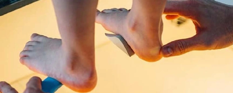 هزینه اسکن کف پا کودکان