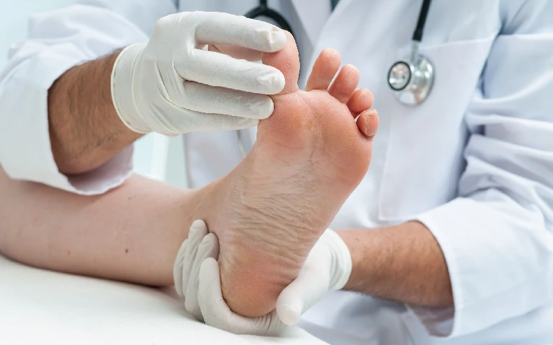 نکات مراقبتی میخچه کف