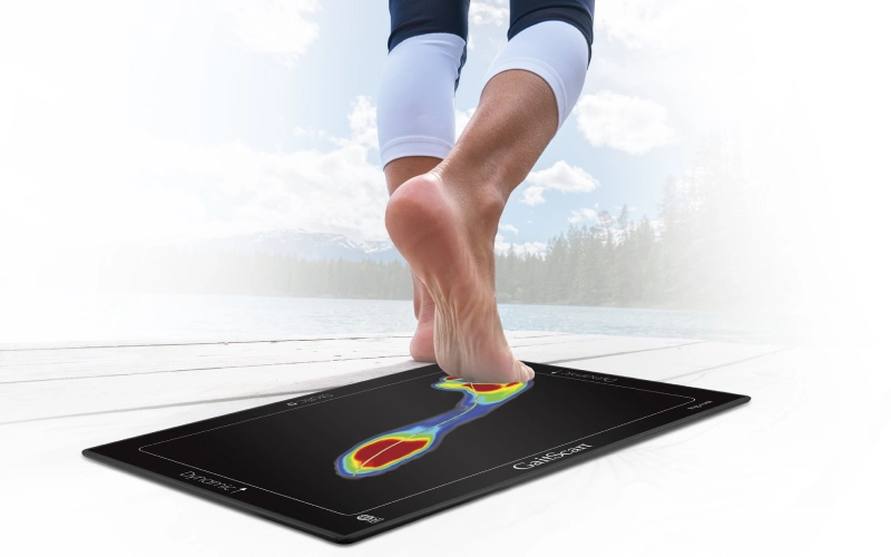 تفسیر اسکن کف پا دقیق