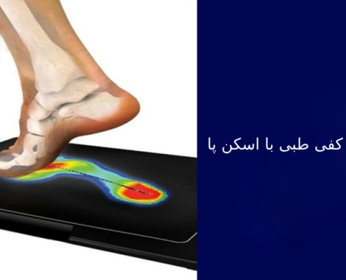 ساخت کفی طبی با اسکن پا