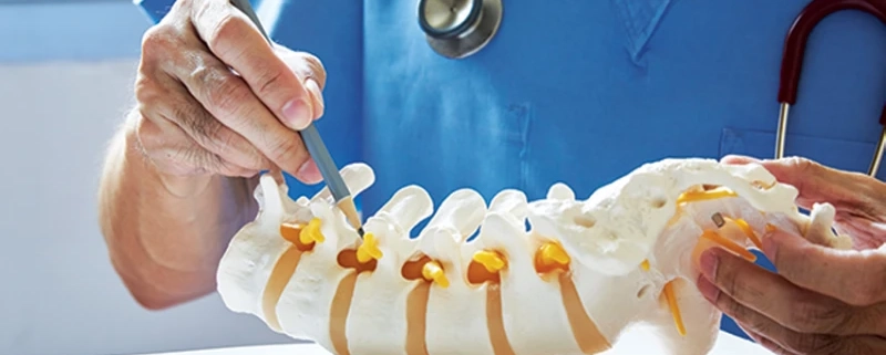 همه چیز درباره دیسک بین مهره ای