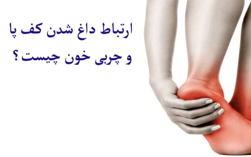 داغ شدن کف پا و چربی خون