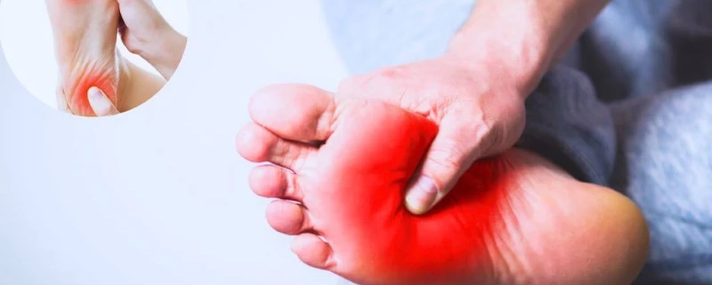 داغی کف پا نشانه چیست؟