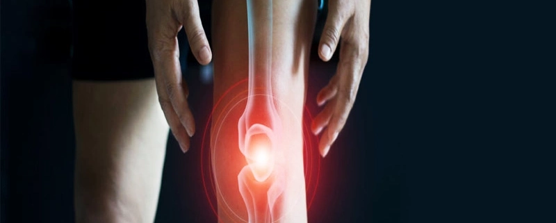 اصلاح انحراف محوری زانو