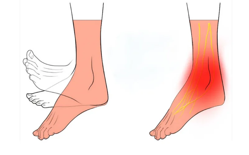 حرکت دایره ای مچ پا برای تسکین دردساق پا
