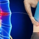 راه های پیشگیری از دیسک کمر