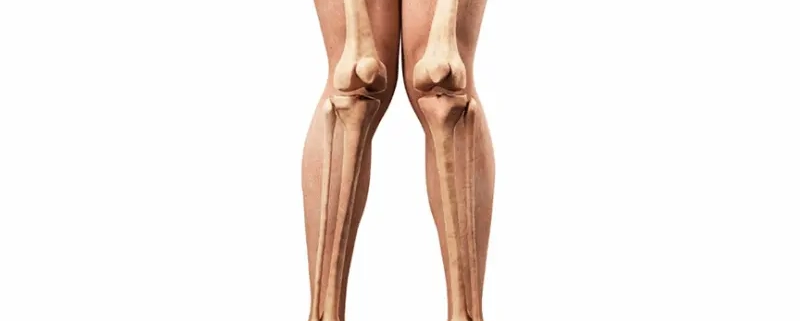 انحراف زانو به داخل چیست؟