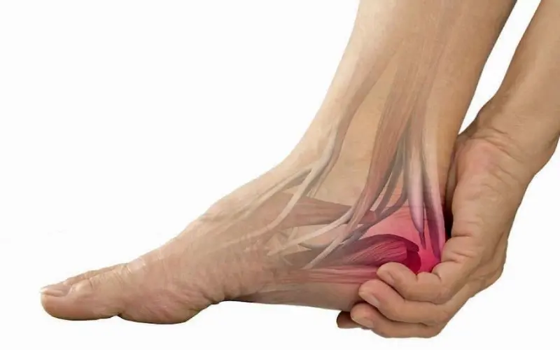 راه های درمان قطعی خارپاشنه