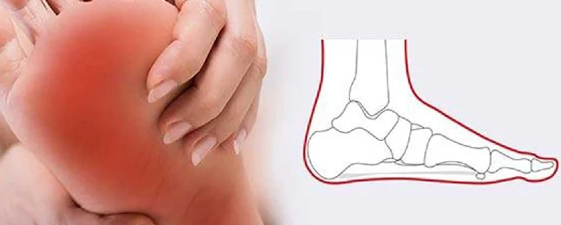 آیا صاف بودن کف پا میتواند باعث زانو درد شود؟