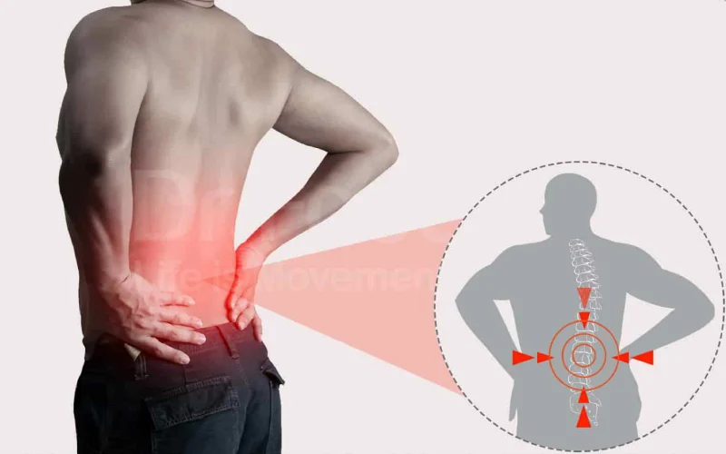 درمان کمردرد ناگهانی