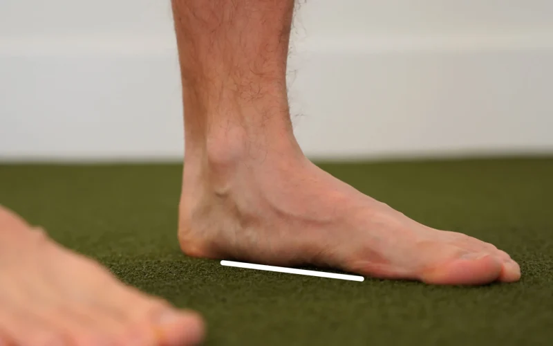 ارتباط کف پای صاف و درد زانو