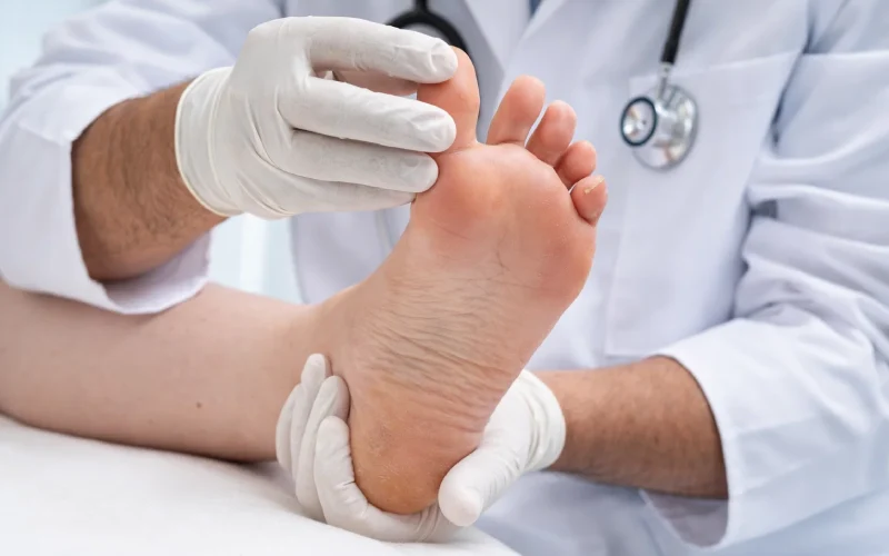 تشخیص و درمان میخچه