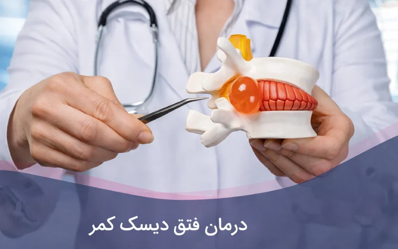 درمان فتق دیسک کمر
