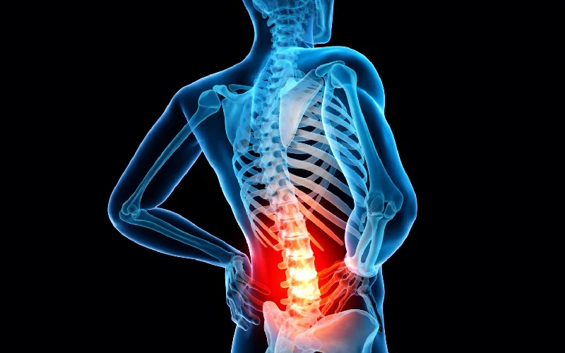 کمر درد چیست؟