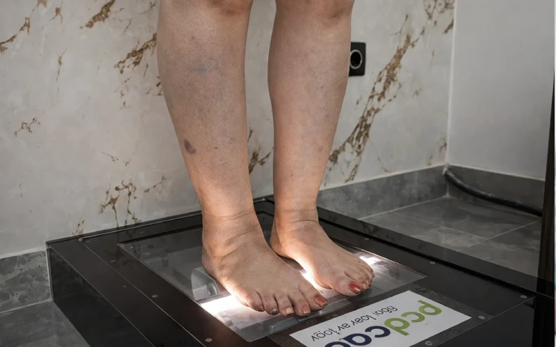 نقش اسکن پا در درمان آرتروز